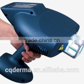 2016 portable handheld home use 308nm Mini excimer treatment device for psoriasis treatment