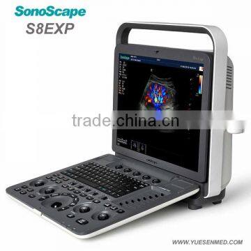 hot medical 4d portable color ultrasound Sonoscape s8exp