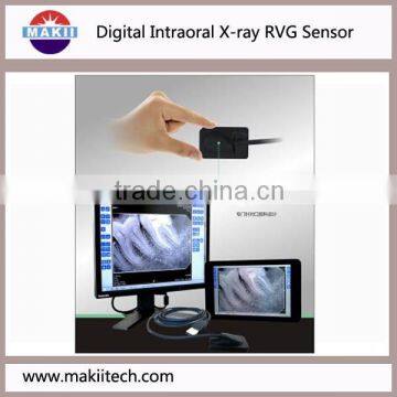 USB Digital intraoral x-ray sensor