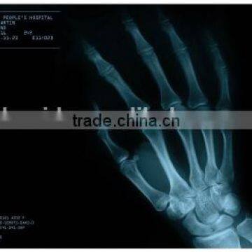 Medical X-ray Film /fuji Printing Clear Image Medical Dry Film With Factory Price photo-5