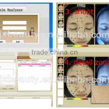 Newest Skin Health Analysis Machine/portable Hair and Skin Analyser Equipment photo-5