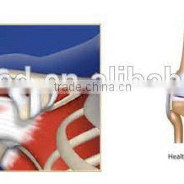 Platelet Rich Plasma PRP Tube photo-6