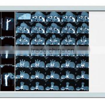 Good X-ray film Illuminator with LED High Luminance