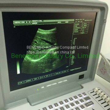 Portable B/W Ultrasound Scanner With Clear Image Quality Hospital Equipment