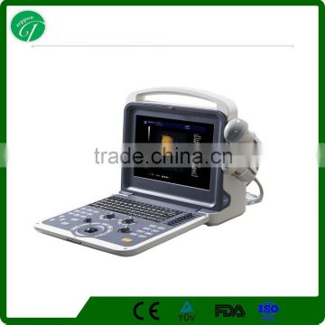 4D Portable 3D 4D Laptop Color Doppler Best Ultrasound Scanner