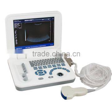 CE Laptop Ultrasound Machine With Multi Frequency Probe Ultrasonic Diagnostic System RUS-9000F2 photo-2