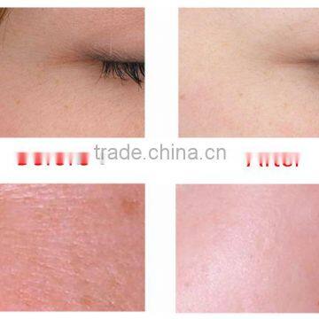 Face Peeling Machine Water Oxygen Jet Peel Machine Water Facial Peeling Best Oxygen Facial Machine CE Certification photo-4
