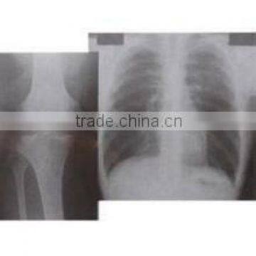 Konida Imagers x ra Blue Sensitive Films Medical Thermal Film China Film photo-5