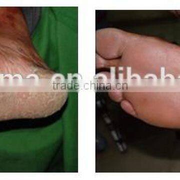 UVB Narrow Band (NB) PL-S 9W/01 311nm Lamps, Hand Held UVB Therapy Lamp photo-2