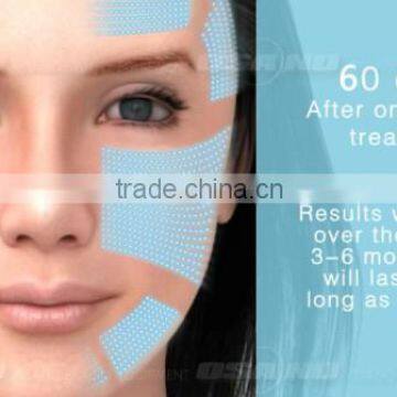 4MHZ LM-S809B Best 2016 Wrinkle High Focused Ultrasonic Remover Feature Hifu Ultrasound Machine 7MHZ photo-5