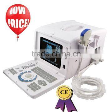 CE approved Laptop/Portable Ultrasound Scanner with 3.5Mhz multi-frequency convex probe RUS-6000D