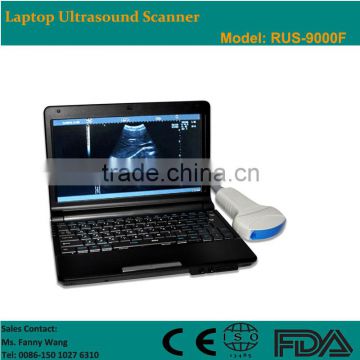 CE approved Laptop Ultrasound Scanner/Ultrasound machine with 3.5Mhz multi-frequency convex probe RUS-9000F