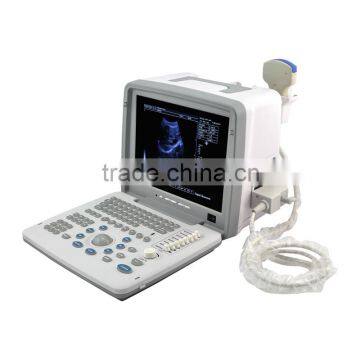 2016 Large Screen LED Hot Sale Portable Ultrasounic Diagnose Scanner Machine System With 2 Probe/Transducer Connector photo-2