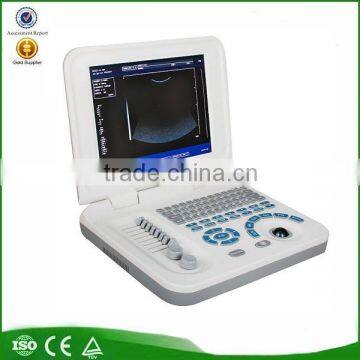 OEM factory 10.4 inch TFT color LCD laptop portable ultrasound machine for pregnancy