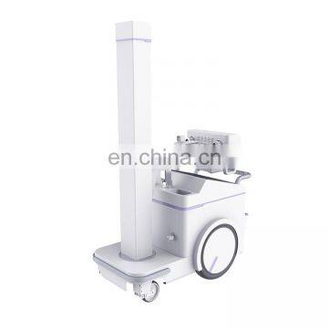 MY-D049V Hospital Device 500mA Digital Mobile Radiography System Medical x Ray Machine Price X-ray Scanner photo-2