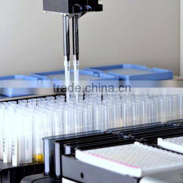 IVD hbsag immunoassay elisa test equipment