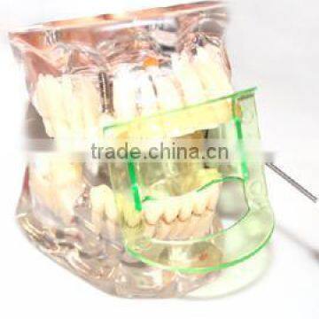 Disposable dental product cheek retractor