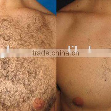 515-1200nm Best Esthetic Device E Light IPL /RF E Light Fine Lines Removal Ipl Opt Hair Removal/Shr Opt Skin Rejuvenation Machine From Sanhe photo-3