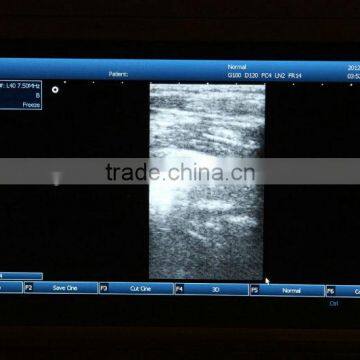 2015 New Laptop Ultrasound Scanner (PC System) on Sale photo-4