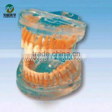 BIX-L1007 Transparent Standard Adult Teeth Model