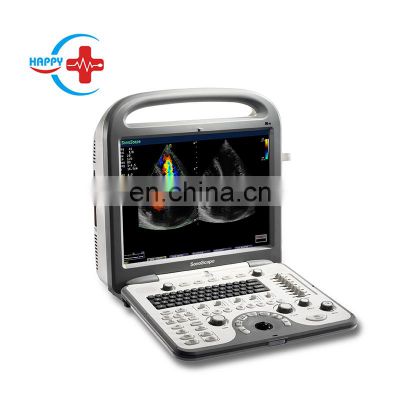 Cheapest Original Sonoscape S8 Portable 4d color doppler ultrasound/Sonoscape ultrasound