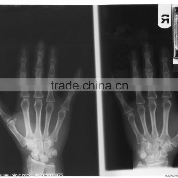 x ray film cassette, medical x ray film of china zhejiang