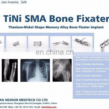 Bone Clasp With Rivet Teeth Ring Shaped TiNi SMA Fixater photo-5