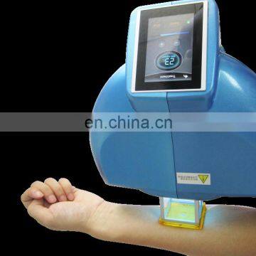 Handheld Excimer Laser 308Nm Psoriasis Vitiligo Laser Unit uv Lamp Vitiligo For Vitiligo Treatment photo-6