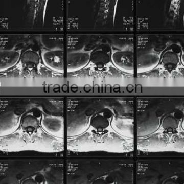 fuji x-ray film from china factory, film dt2b,agfa x-ray film of alibaba supplier