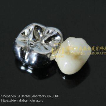Full Metal Crown, FMC, FGC, Full Metal Post Core, Dental Crown, Cast Metal Crown, Dental Prosthesis, Laboratorio Dental, Dental Laboratory, Dentallabor, LJ Dental Lab China photo-3