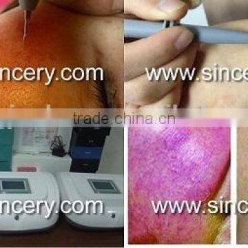 Portable Spider Vein Elimination Machine for Sale