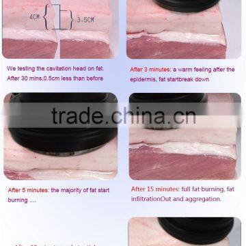 5 in 1 Ultrasund Cavitation Weight Loss Electric Body Shaper Slimming photo-4