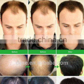 Grey Hair Thickening Fiber With Private Label of Hair Thickener Spray photo-4
