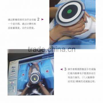 2016 Newest Wight Loss Machine Ultrashape Body Slimming Machine photo-3