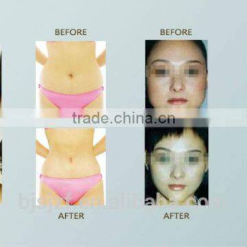 SL-4 Vacuum Cryolipolysis Fat Freezing Liposuction 220 / 110V Slimming Machine With CE Slimming Reshaping photo-5