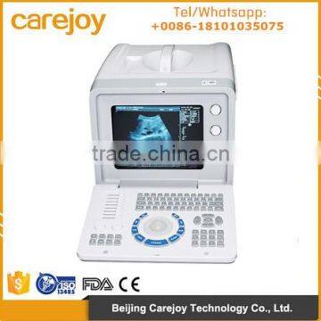 10 inch Ultrasound Scanner Diagnostic System RUS 6000D with 3.5MHz Convex Probe optional Sony video thermal recorder