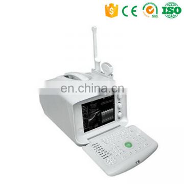 MY-A001A Laptop full digital portable ultrasound scanner mini ultrasound machine