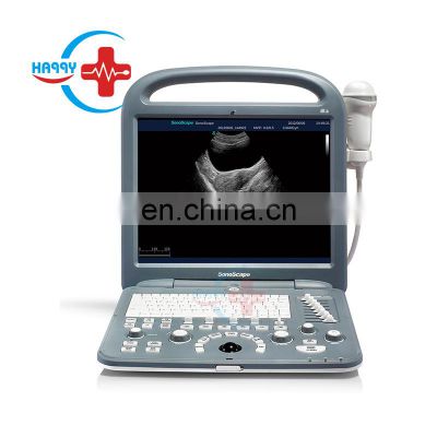 Best Portable ultrasound machine price /Sonoscape S2 /SonoScape ultrasound machine