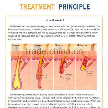 Promotion 808nm d Diode Laser Equipment for All Kinds of Hair Removal photo-6