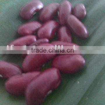 2011 Crop British Red Kidney Bean