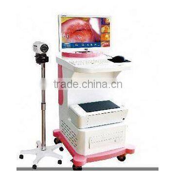 china digital electronic colposcope with new model