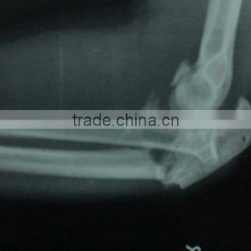 china wholesale Medical image film used by open mri