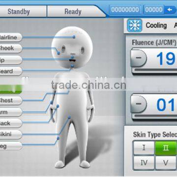 2016 Newest Alma Laser Soprano Ice 808nm Diode Laser Hair Removal Machine/808nm Laser Hair Removal Machine photo-5