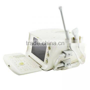 Factory OEM Design Reliable Performance Cheap pc Based Ultrasound Scanner for Human photo-2