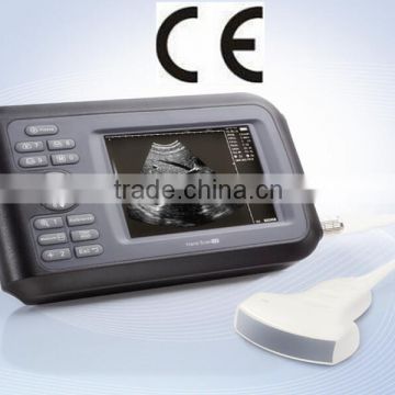 CE certificated Palm Ultrasound Scanner HandScan H8 with Convex Linear Transvaginal micro-convex Probe