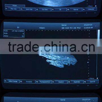 Beautiful Compact Diagnostic Ultrasound Probe / Mini Ultrasound Machine / Portable Ultrasound Scanner photo-6