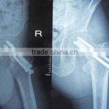 China radiografias extraorales film KND-A/F CE