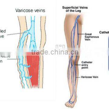 2015 Newest Technology 980nm 940nm Diode Laser Spider Veins Removal Diode Laser Spider Veins Removal Machine for Sale photo-5