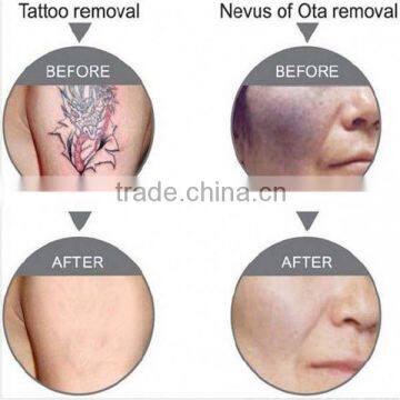 Best China Hot Sale!! Super Fast Color Touch Screen High Power Laser Tattoo Removal Machine 10HZ photo-6