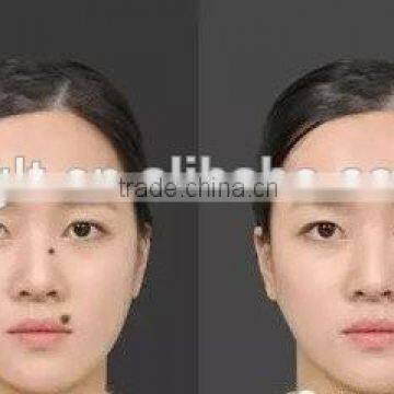 Metal Laser Spot Skin Mole Removal Machine With 12pcs Needles